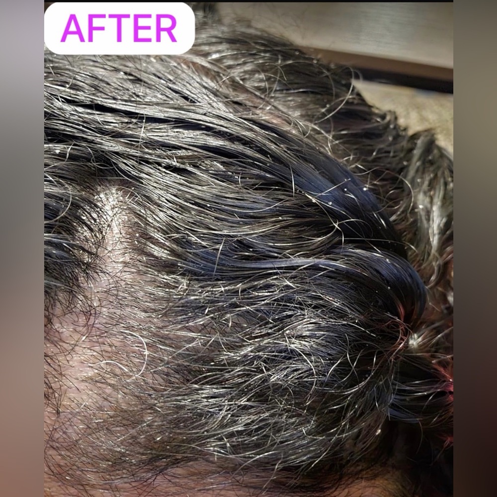 Nizoral Anti-Dandruff Shampoo - Picture 3 of 4